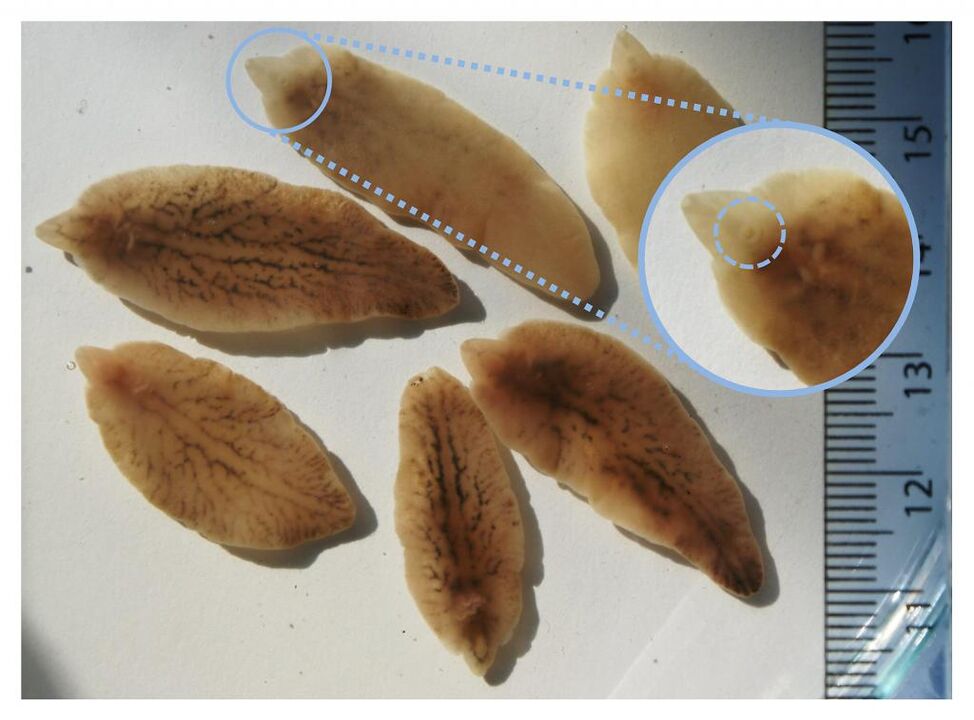 Fígado fluke