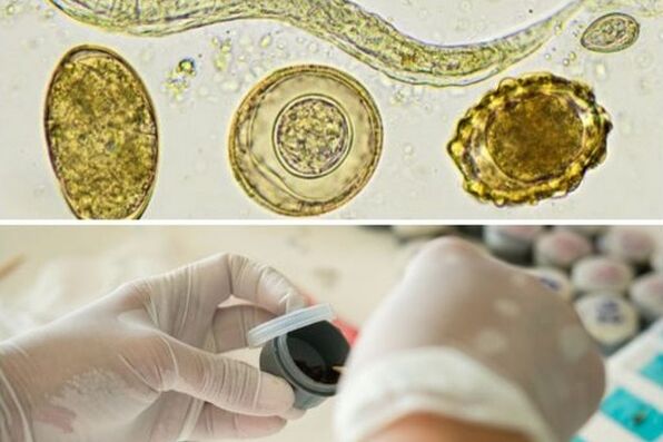Diagnosticar a presenza de parasitos no corpo