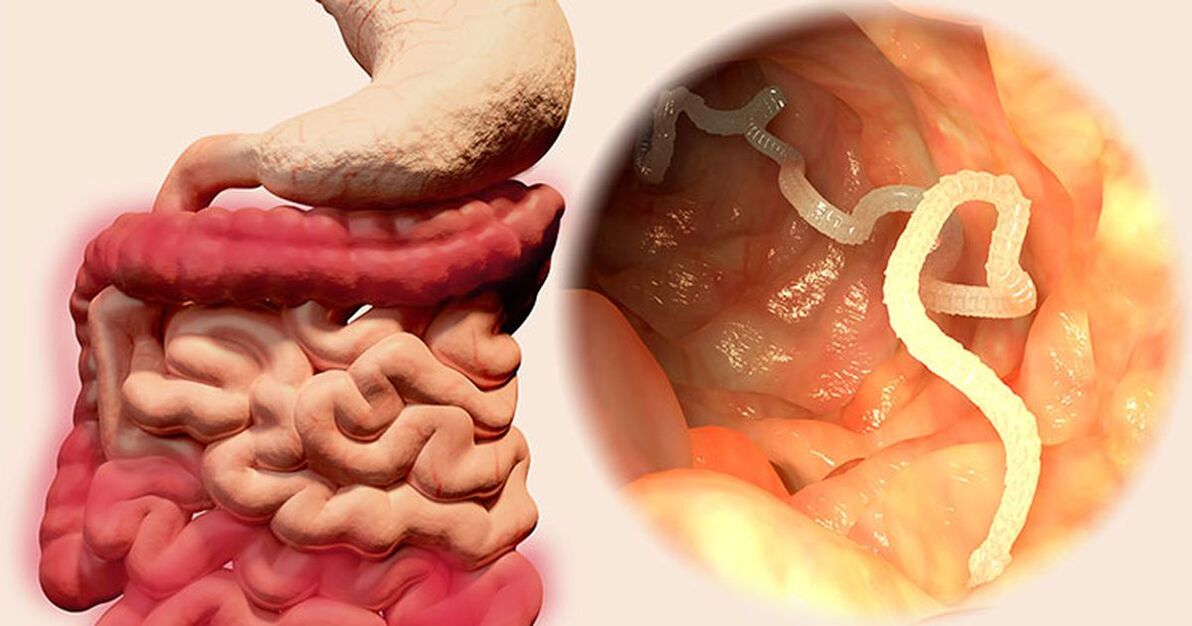 Parasitos no intestino humano