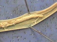 parasito